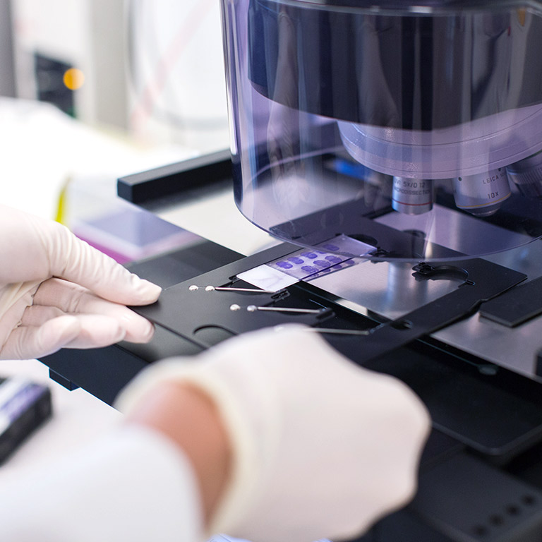 Microscope for glaucoma research